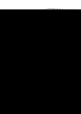 ACIDUM NITRICUM D 5 Dilution